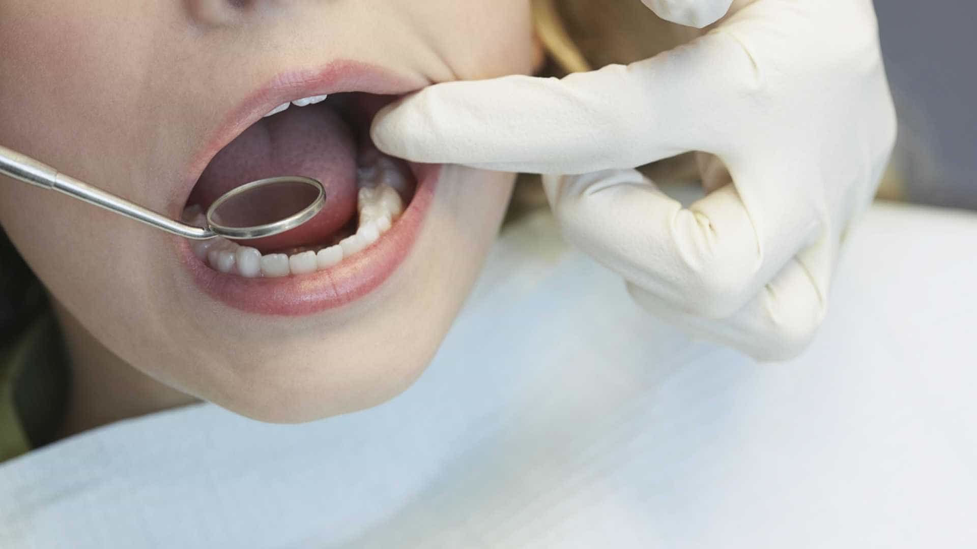 La cura per i tuoi denti